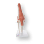 Kniegewricht - Functioneel model - Anatomie en pathologie