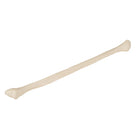 Fibula - Anatomy and pathology