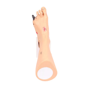 Foot model with wounds - Anatomy and pathology My Podiatry 