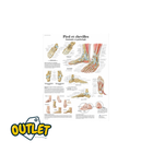 Planche anatomique - Pied et chevilles - Anatomie et pathologie // Défaut
