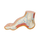 Skelet van een holle voet (Pes Cavus)
